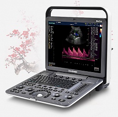 Ультразвуковой сканер Sonoscape S8Exp